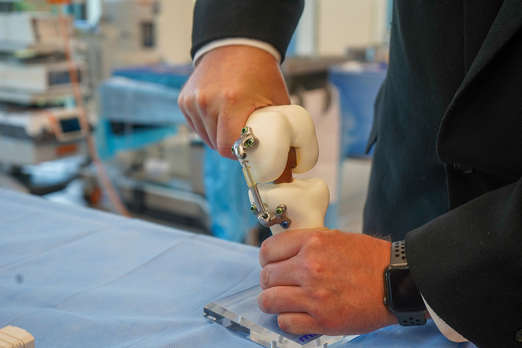 Imagen: El dispositivo amortiguador para prevenir o retrasar el reemplazo de la rodilla está bajo consideración por la FDA (Fotografía cortesía de la Universidad Estatal de Ohio)
