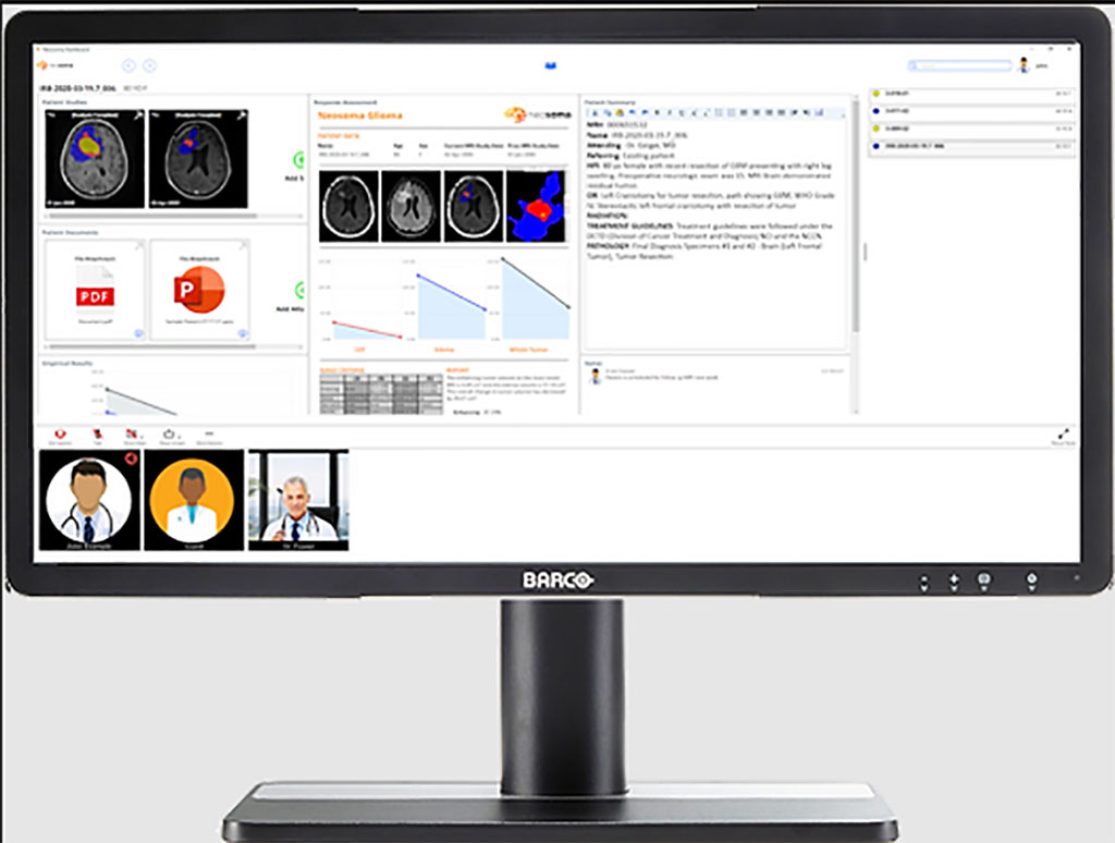 Imagen: Neosoma HGG es el primer software de neuro-oncología basado en IA en recibir la autorización 510 (k) de la FDA (Fotografía cortesía de Neosoma) Imagen: Neosoma HGG es el primer software de neuro-oncología basado en IA en recibir la autorización 510 (k) de la FDA (Fotografía cortesía de Neosoma)