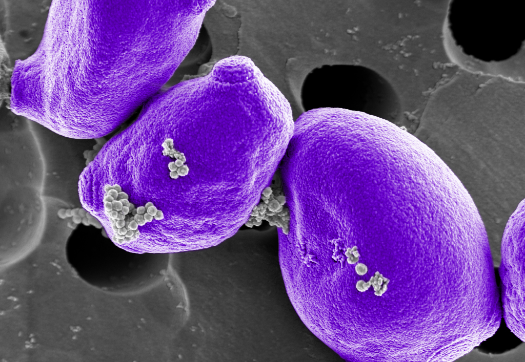 Imagen: La proteína FCMBL modificada genéticamente puede capturar más de 100 especies microbianas diferentes (Fotografía cortesía del Instituto Wyss)