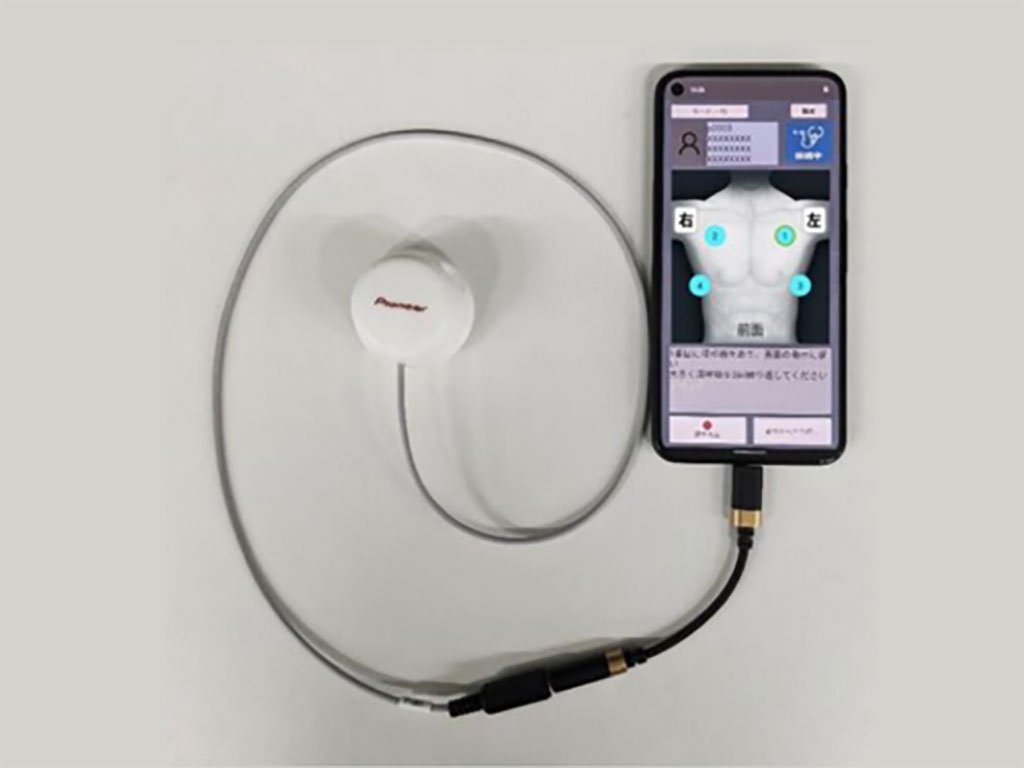 Imagen: El nuevo dispositivo  remoto de monitoreo de sonido respiratorio  (Fotografía cortesía de la Universidad de Hiroshima)