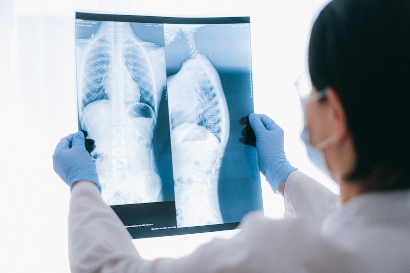 Los investigadores usaron IA para clasificar a los pacientes con dolor en el pecho (Fotografía cortesía de Pexels) Los investigadores usaron IA para clasificar a los pacientes con dolor en el pecho (Fotografía cortesía de Pexels)
