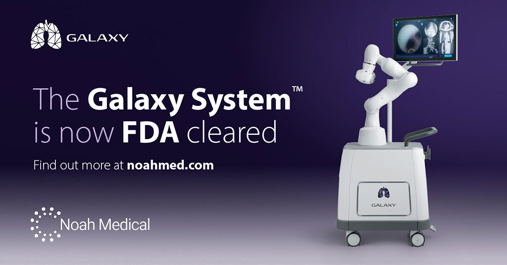 Imagen: El Galaxy System ha recibido la autorización de la FDA para la broncoscopia con navegación robótica (Fotografía cortesía de Noah Medical)