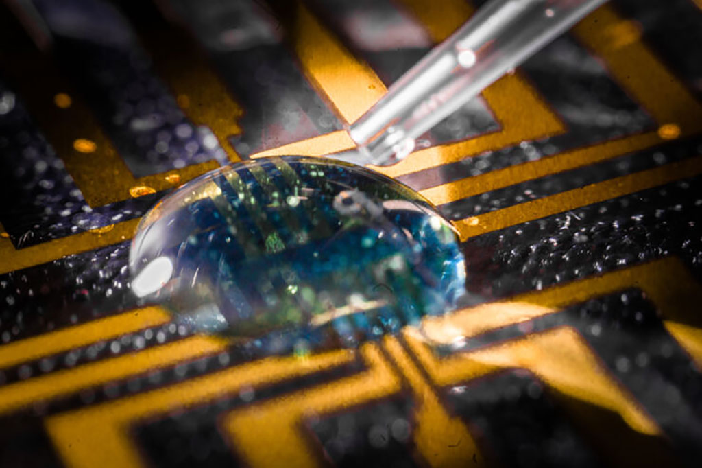 Imagen: Usando el gel inyectable, los investigadores pudieron cultivar electrodos en tejido vivo (Fotografía cortesía de la Universidad de Linköping)
