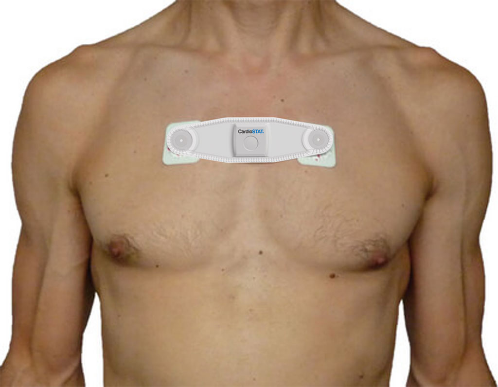 Imagen: CardioSTAT permite monitoreo cardíaco ambulatorio simple, confiable, sin cables (Fotografía cortesía de Icentia)