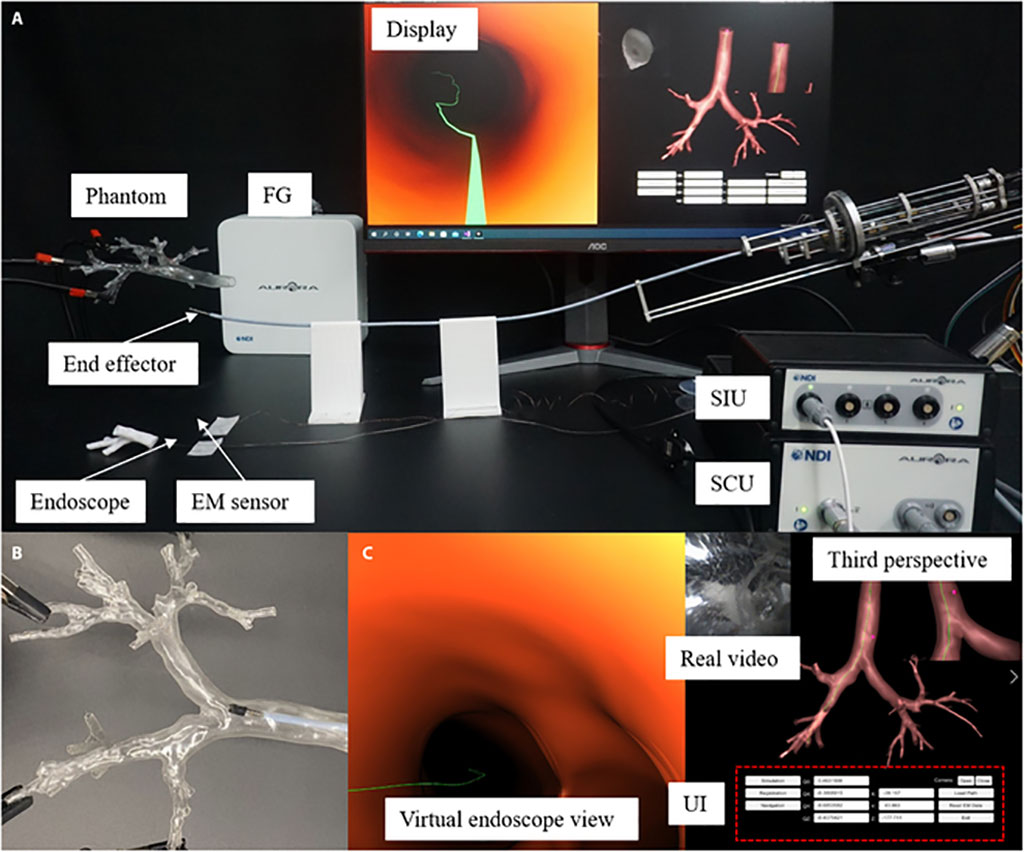 Imagen: Sistema de broncoscopio robótico propuesto para la biopsia de lesiones pulmonares (Fotografía cortesía del Instituto de Tecnología de Beijing)