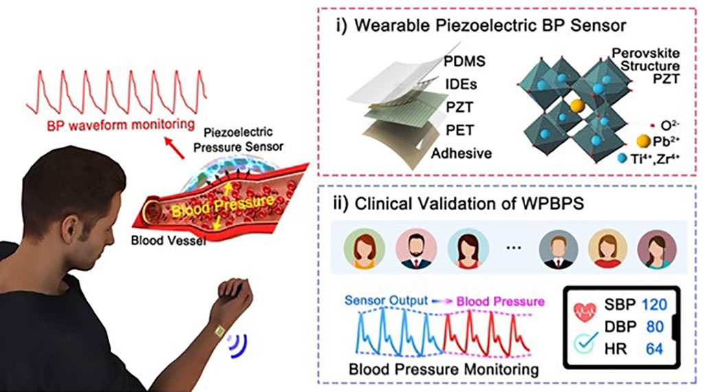 Imagen: Ilustración esquemática del concepto general para un sensor de presión arterial piezoeléctrico portátil (Fotografía cortesía de KAIST)