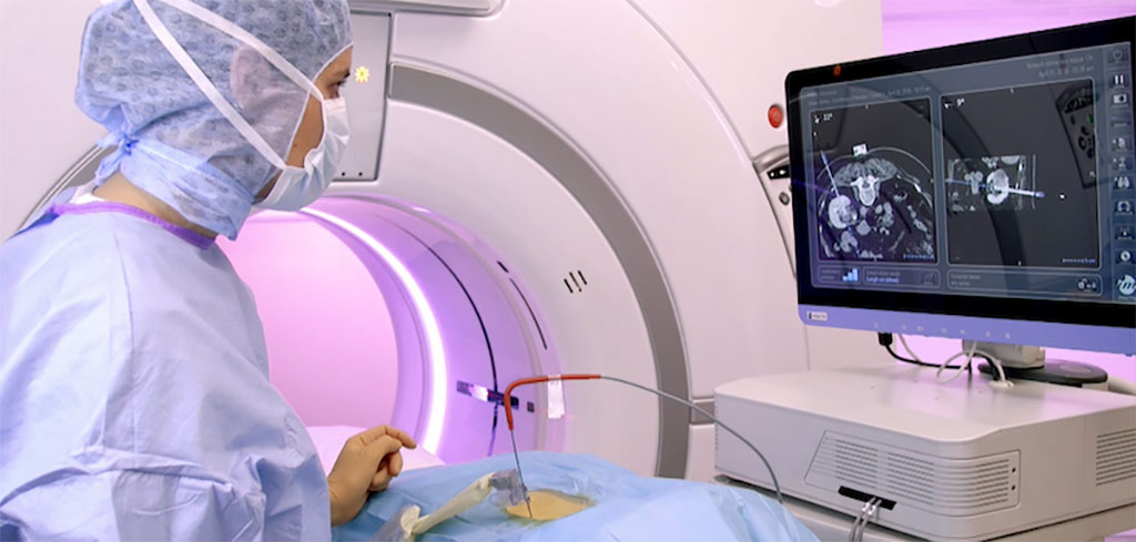 Imagen: CT-Navigation es una solución innovadora para ayudar a expandir el acceso a la TC intervencionista (Fotografía cortesía de GE Healthcare)