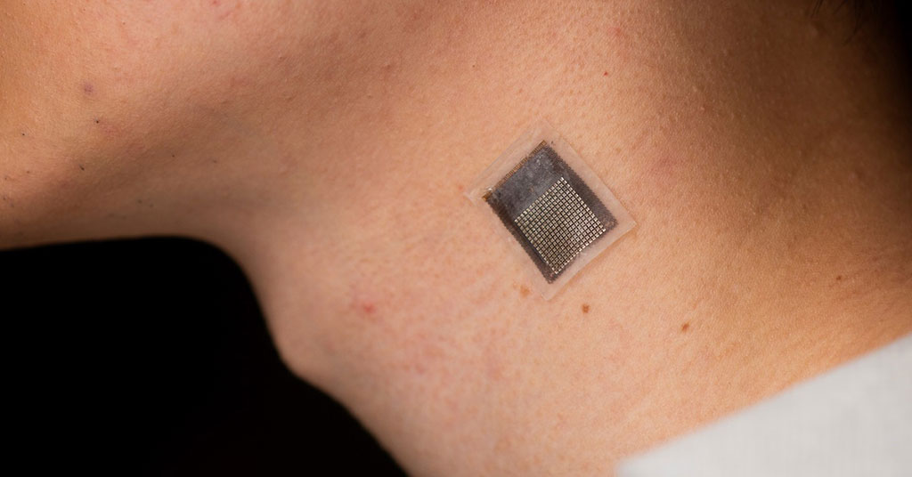 Imagen: El parche de ultrasonido portátil mide la rigidez del tejido de manera más efectiva (Fotografía cortesía de UC San Diego)