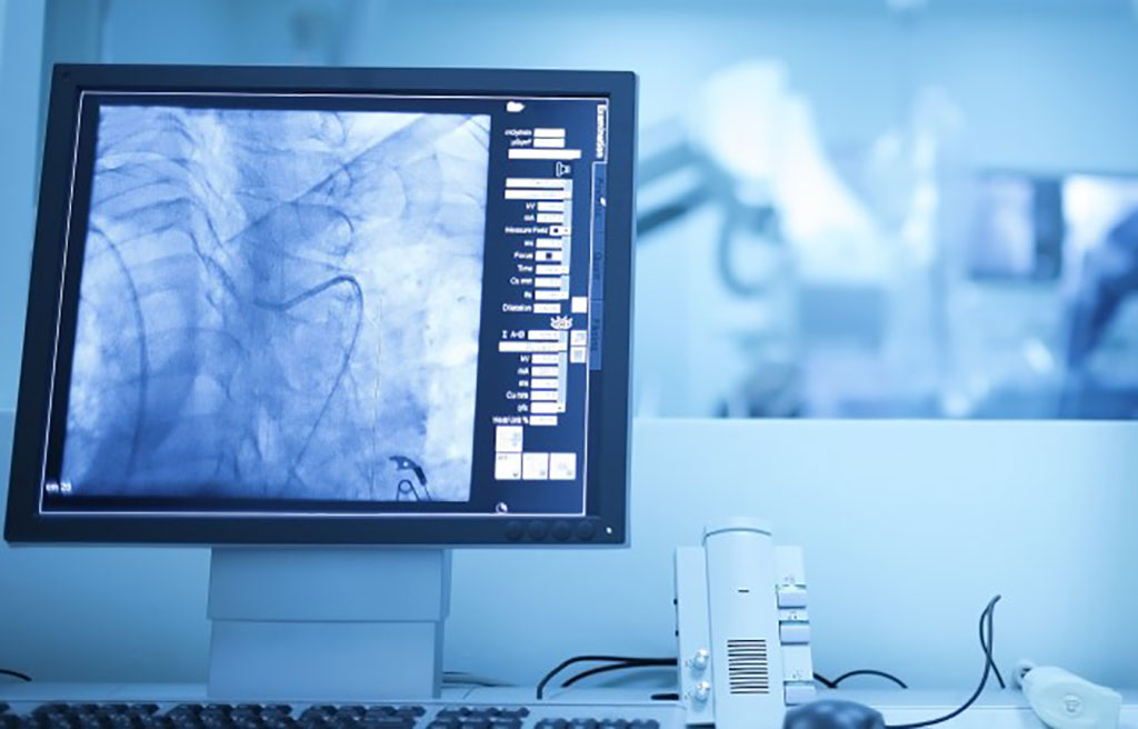 Imagen: La tecnología virtual de los vasos sanguíneos podría mejorar el cuidado de las enfermedades cardíacas (Fotografía cortesía de BHF)