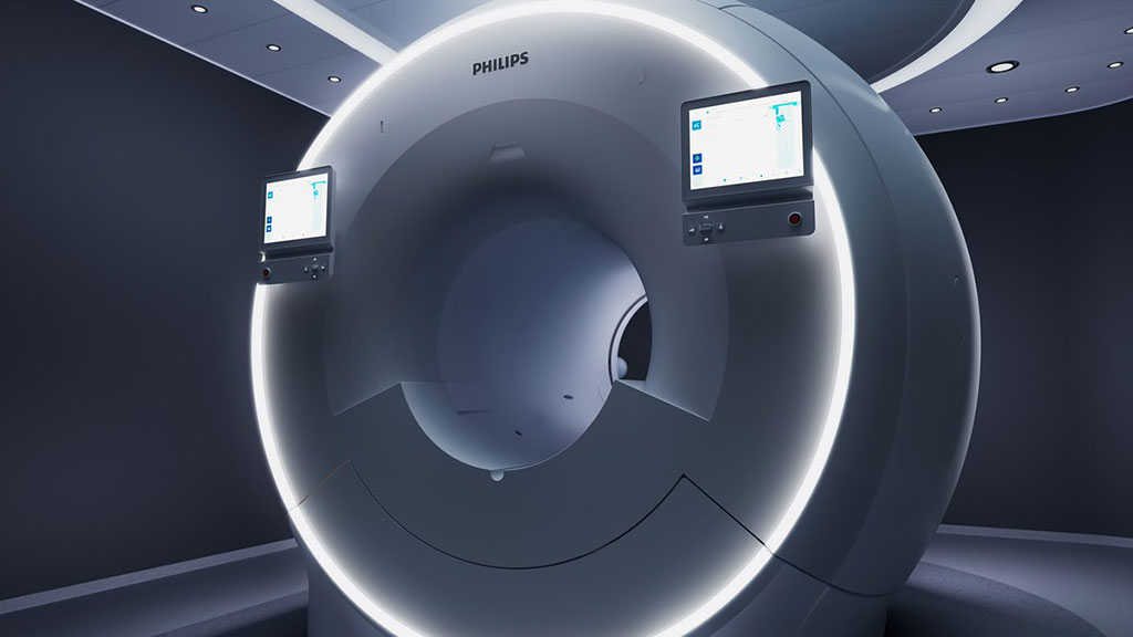 Imagen: El innovador sistema MR 7700 agrega capacidades de xenón para mejorar las imágenes de ventilación (Fotografía cortesía de Philips) Imagen: El innovador sistema MR 7700 agrega capacidades de xenón para mejorar las imágenes de ventilación (Fotografía cortesía de Philips)