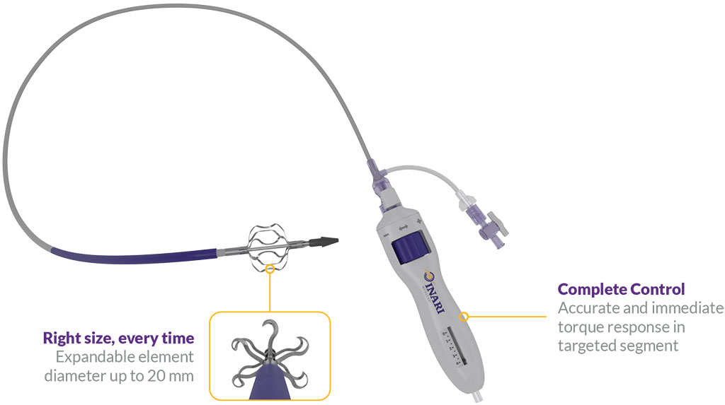 Imagen: RevCore es un dispositivo de trombectomía mecánica para la trombosis venosa en el stent (Fotografía cortesía de Inari Medical)