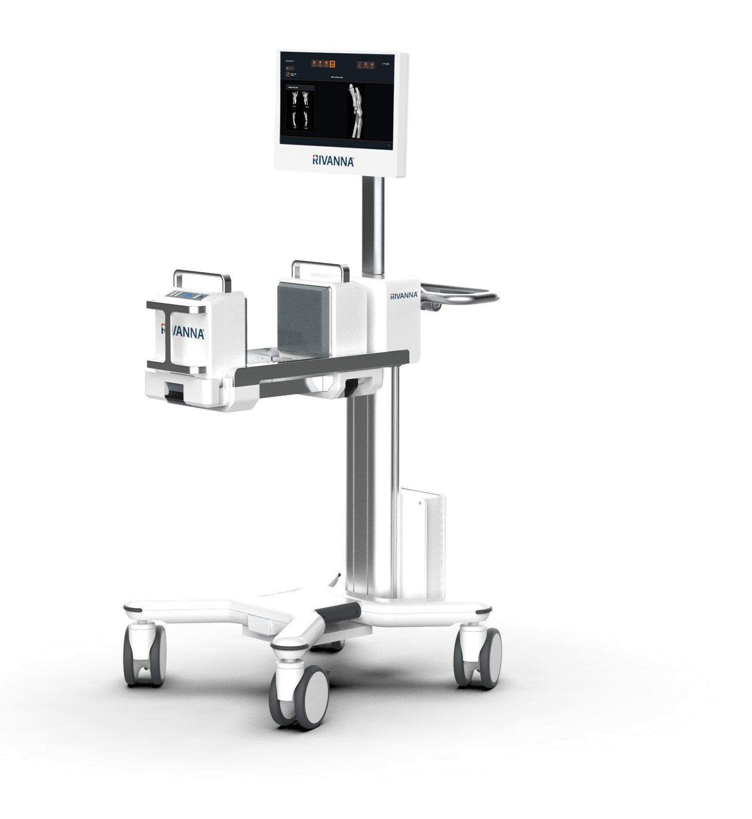 Imagen: Accuro XV integra la tecnología de imágenes de tejidos blandos 3D basada en ultrasonido con software habilitado para IA (Fotografía cortesía de RIVANNA) Imagen: Accuro XV integra la tecnología de imágenes de tejidos blandos 3D basada en ultrasonido con software habilitado para IA (Fotografía cortesía de RIVANNA)