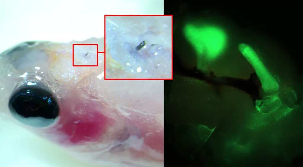 Imagen: Las áreas verdes en el cerebro del pez cebra indican que las células nerviosas envían señales eléctricas cuando el electrodo implantado transmite estímulos externos (Fotografía cortesía de la Universidad de Lund)