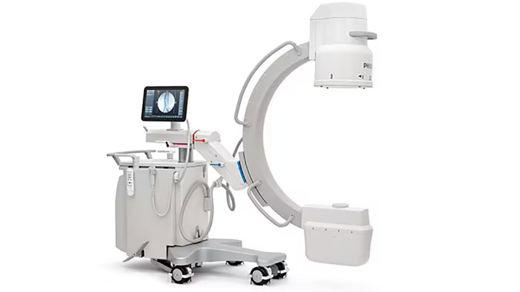 Imagen: El arco en C móvil Zenition 70 con detector plano (Fotografía cortesía de Philips) Imagen: El arco en C móvil Zenition 70 con detector plano (Fotografía cortesía de Philips)