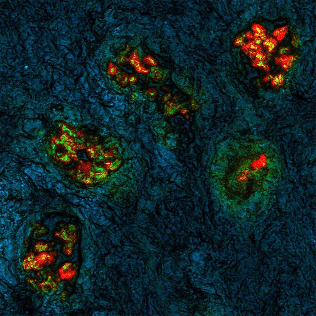 Imagen: La técnica visual y cuantitativa se ha probado utilizando muestras de múltiples tipos de cáncer (Fotografía cortesía de Mass General Brigham)