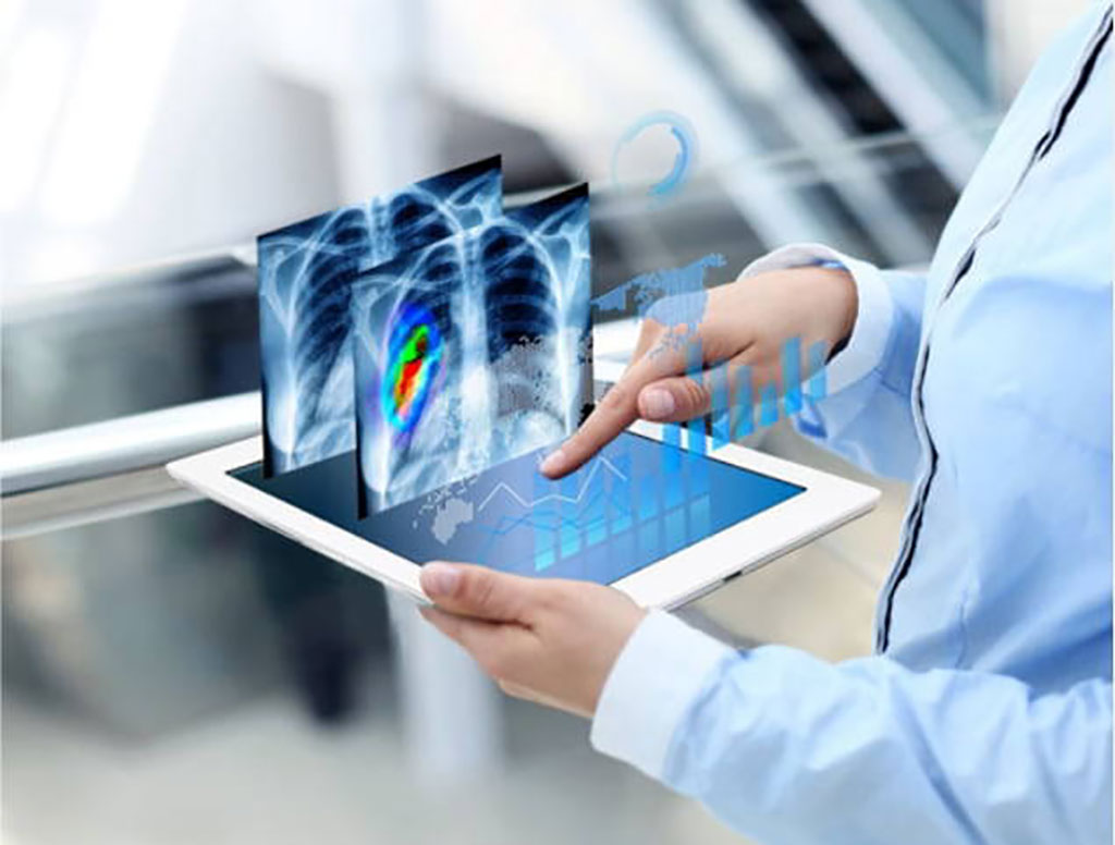 Imagen: Se espera que los nuevos productos de imágenes médicas con IA aprobadas por la FDA de EUA aumenten cinco veces para 2035 (Fotografía cortesía de ACR DSI) Imagen: Se espera que los nuevos productos de imágenes médicas con IA aprobadas por la FDA de EUA aumenten cinco veces para 2035 (Fotografía cortesía de ACR DSI)