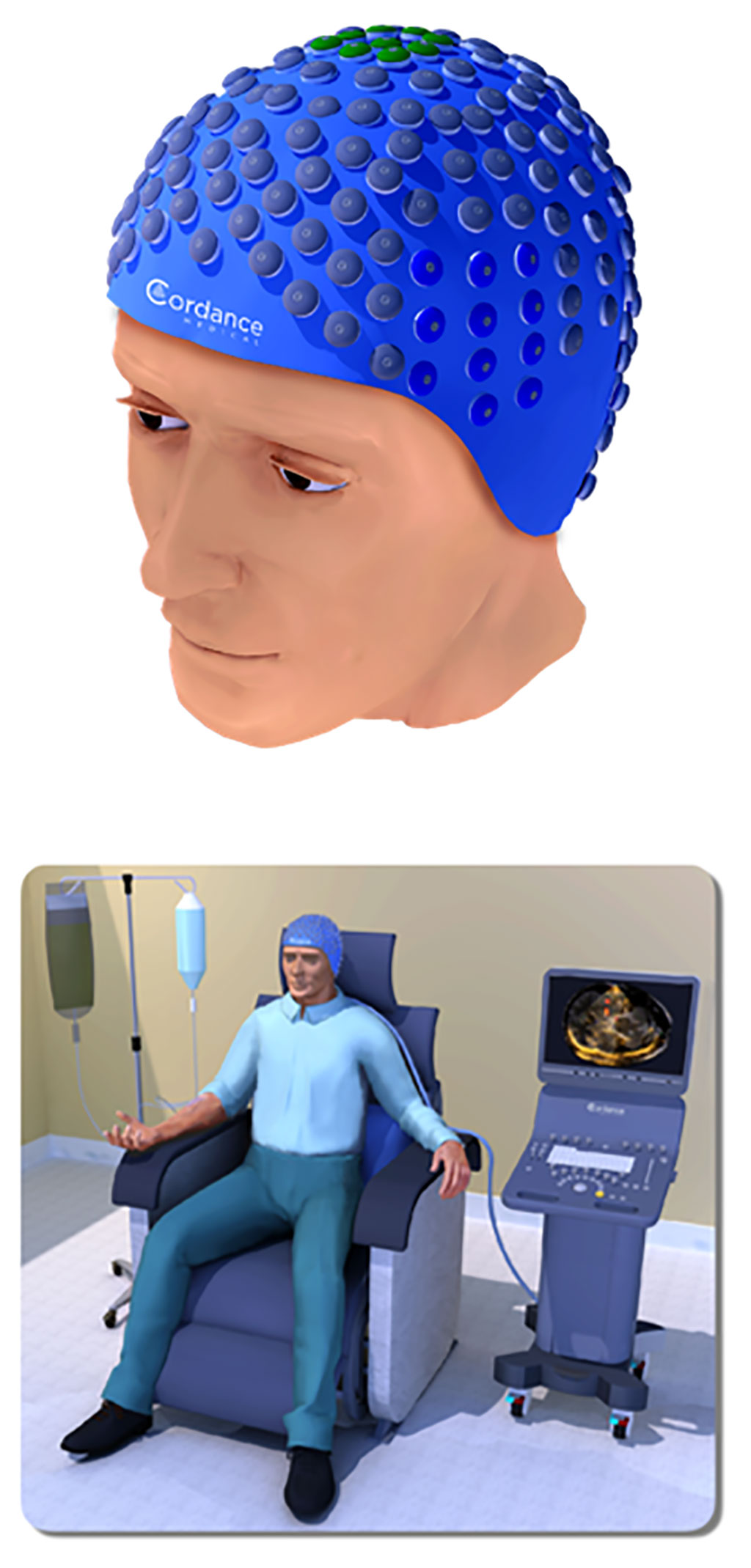 Imagen: El dispositivo NeuroAccess ha recibido la designación de dispositivo innovador de la FDA para biopsia líquida en tumores cerebrales (Fotografía cortesía de Cordance Medical)