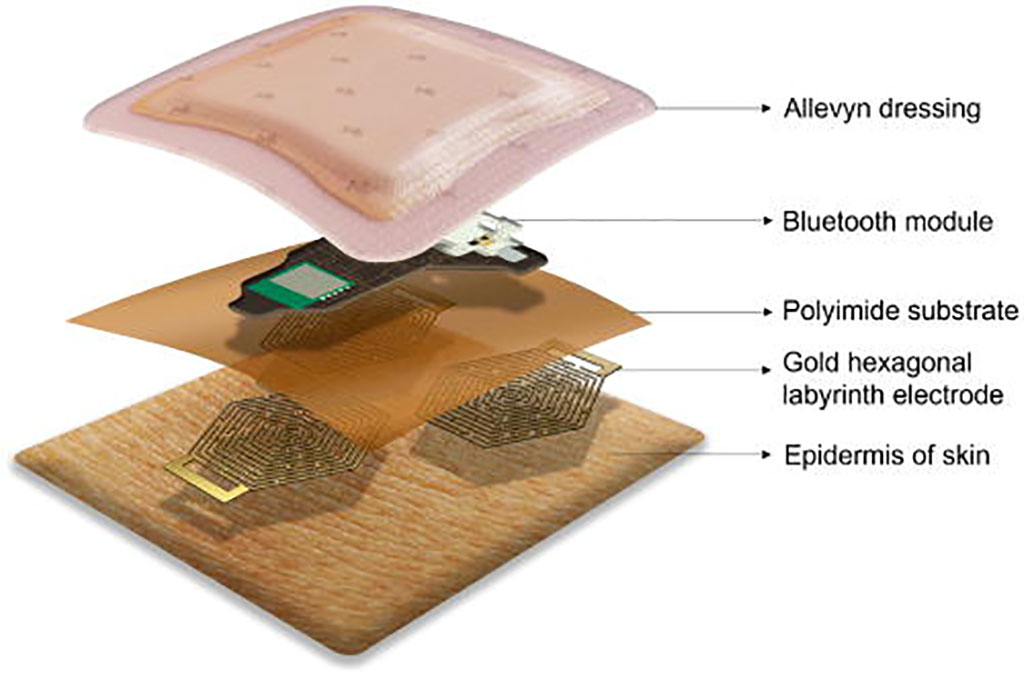 Imagen: Esquema del dispositivo ECG de electrodo seco portátil e inalámbrico adherido a la piel (Fotografía cortesía de Applied Physics Reviews)