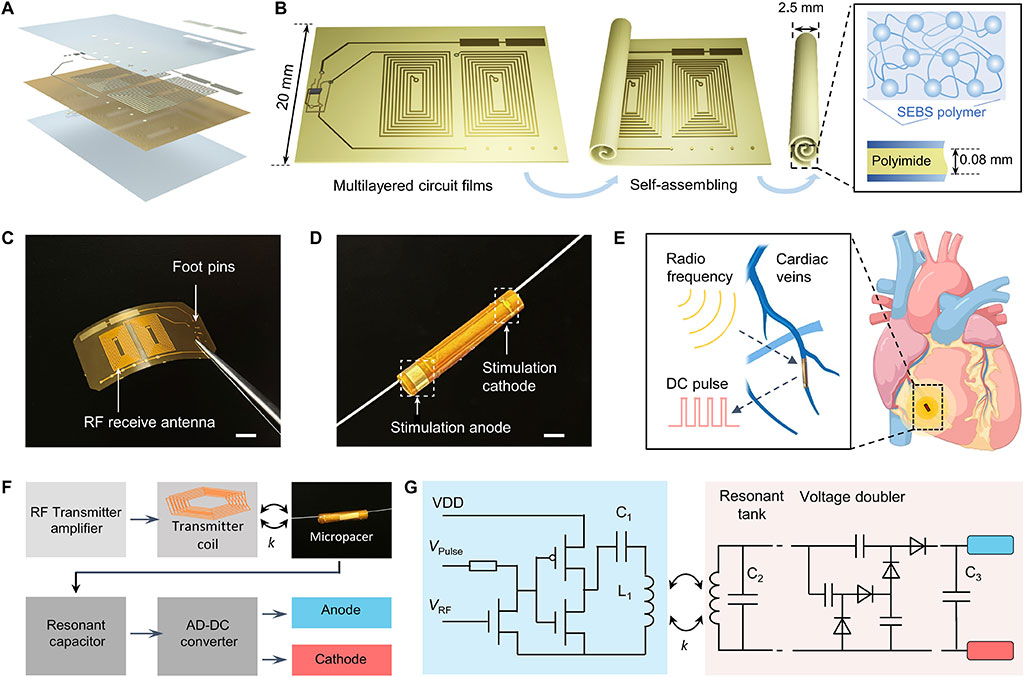 Imagen: El marcapasos microtubular implantable paraelectroestimulación inalámbrica (Fotografía cortesía de Science Advances)