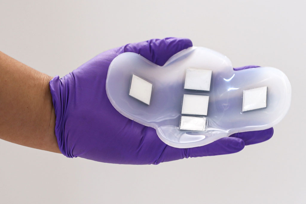 Imagen: El nuevo parche de ultrasonido puede medir qué tan llena está la vejiga (Fotografía cortesía del MIT) Imagen: El nuevo parche de ultrasonido puede medir qué tan llena está la vejiga (Fotografía cortesía del MIT)