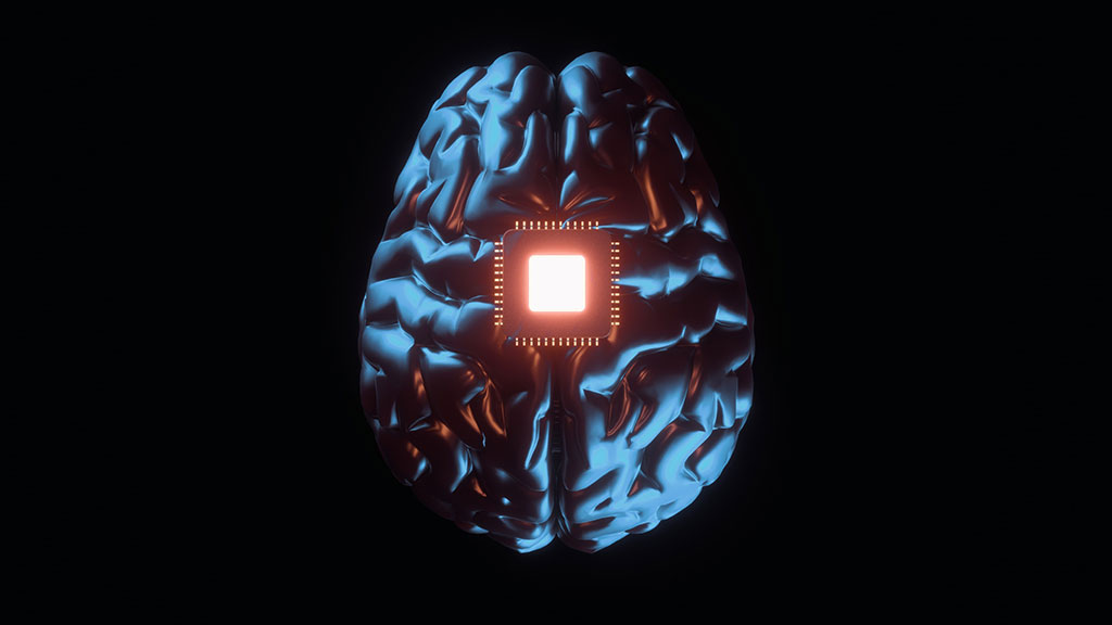 Imagen: Un dispositivo implantado en el cerebro puede mejorar la capacidad de concentración, memoria y estado de ánimo (Fotografía cortesía de 123RF)