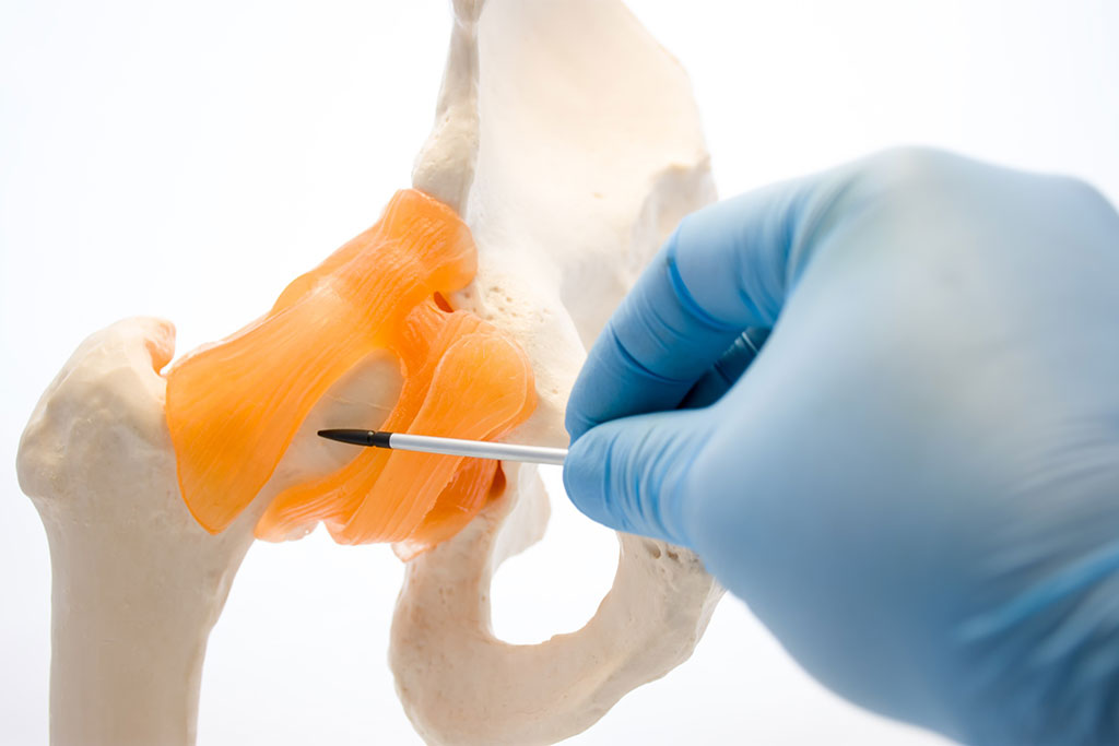 Imagen: Un nuevo recubrimiento para implantes ortopédicos puede repeler la infección (Fotografía cortesía de 123RF)