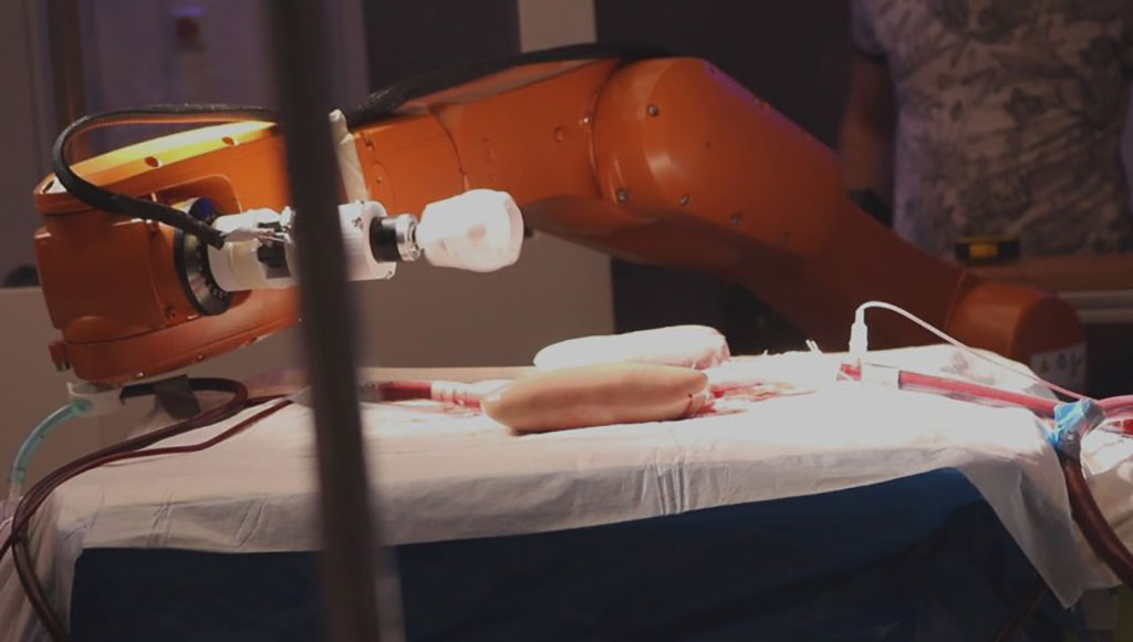 Imagen: Los milirobots inalámbricos pueden navegar con éxito las arterias (Fotografía cortesía de la Universidad de Twente)