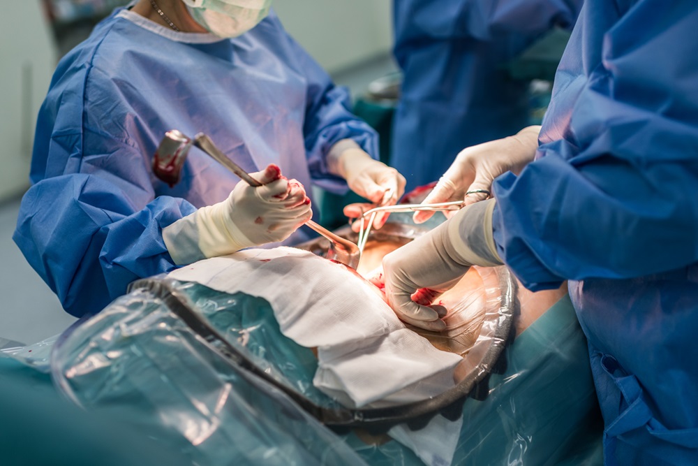 Imagen: Cuatro mujeres se sometieron a una cirugía dos en uno para reducir su riesgo de cáncer de ovario (Fotografía cortesía de Shutterstock)