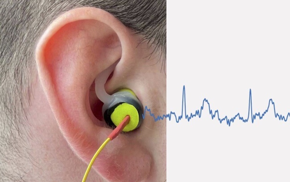 Imagen: La investigación muestra cómo un pequeño dispositivo en el canal auditivo puede monitorear la salud del corazón (Fotografía cortesía de Danilo Mandic)