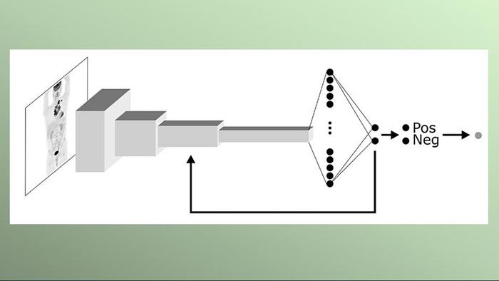 Imagen: El modelo AI ingresa y analiza una imagen de la tomografía de emisión de positrones (PET) (Fotografía cortesía de la Universidad de Chalmers)