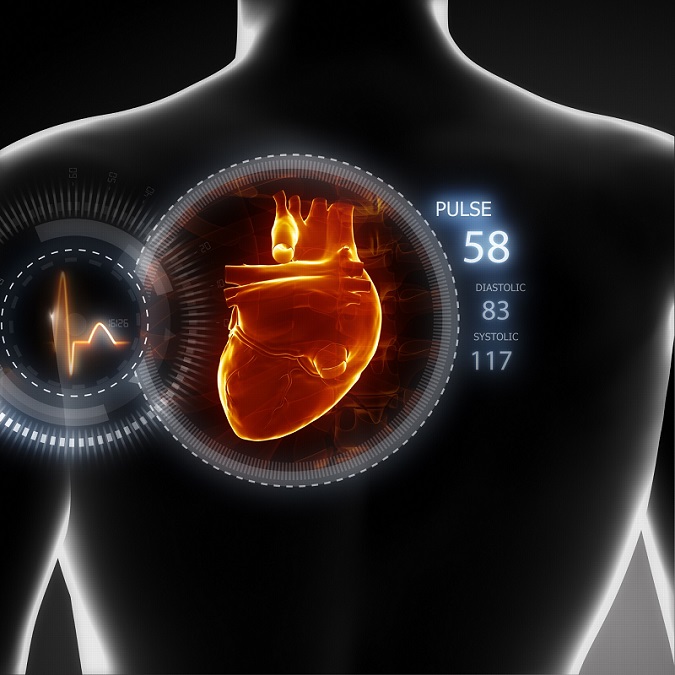 Imagen: Los investigadores han desarrollado una nueva puntuación de riesgo para complicaciones cardiovasculares después del trasplante de médula ósea (Fotografía cortesía de 123RF)