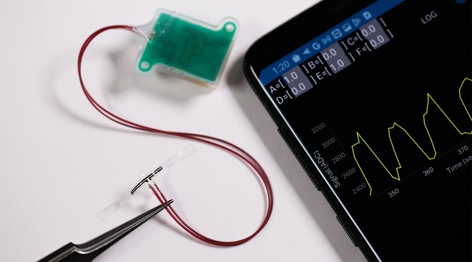 Imagen: El nuevo dispositivo para monitorear la vejigaestá compuesto por múltiples sensores que trabajan juntos para medir la tensión (Fotografía cortesía de la Universidad Northwestern)