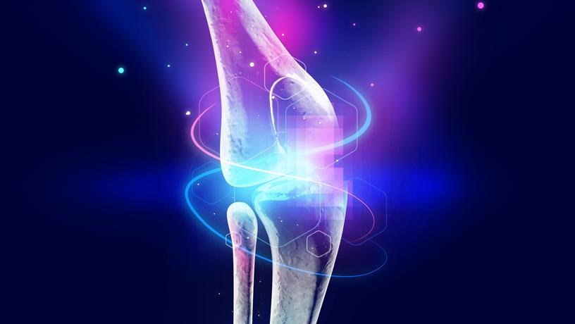 Imagen: La rodilla de reemplazo viva se probará en ensayos clínicos dentro de cinco años (Fotografía cortesía de ARPA-H)