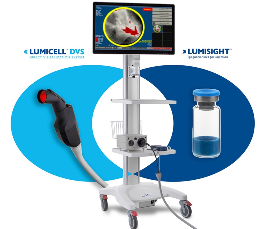 Imagen: Lumisight y Lumicell DV ofrecen una precisión diagnóstica del 84 % en la detección de cáncer residual (foto cortesía de Lumicell)