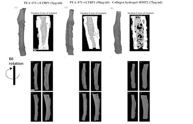 Imagen: El avance de la bioingeniería ayuda a reparar huesos dañados sin causar efectos secundarios negativos (foto cortesía de Dhawan, et al.; Https://doi.org/10.1002/adma.202310789)