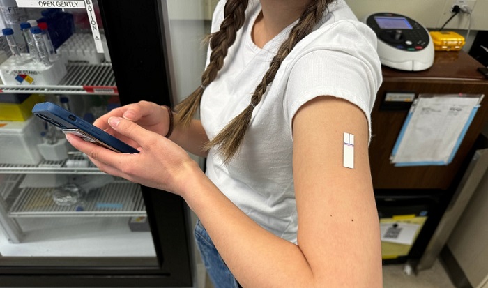 Imagen: El parche Wearable Aptalyzer recopila y envía información sobre los marcadores en el líquido a un teléfono inteligente (foto cortesía de la Universidad McMaster)