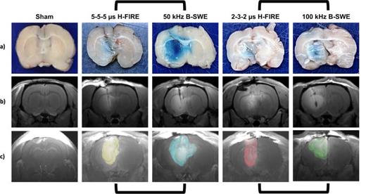 Imagen:  Una visualización de la alteración de la barrera hematoencefálica una hora después del tratamiento  (foto cortesía de APL Bioengineering)