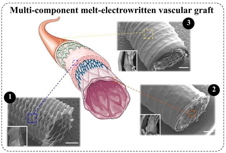 Imagen: El injerto vascular multicomponente supera las limitaciones de los injertos vasculares autólogos/sintéticos (foto cortesía de Trinity College Dublin)