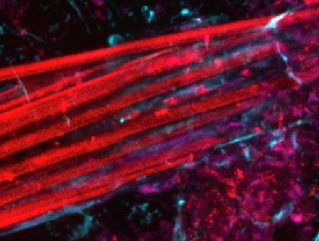 Imagen microscópica de un haz de fibras de electrodos extremadamente finas en el cerebro (Foto cortesía de Yasar TB, et al. Nature Communications 2024, modificada)