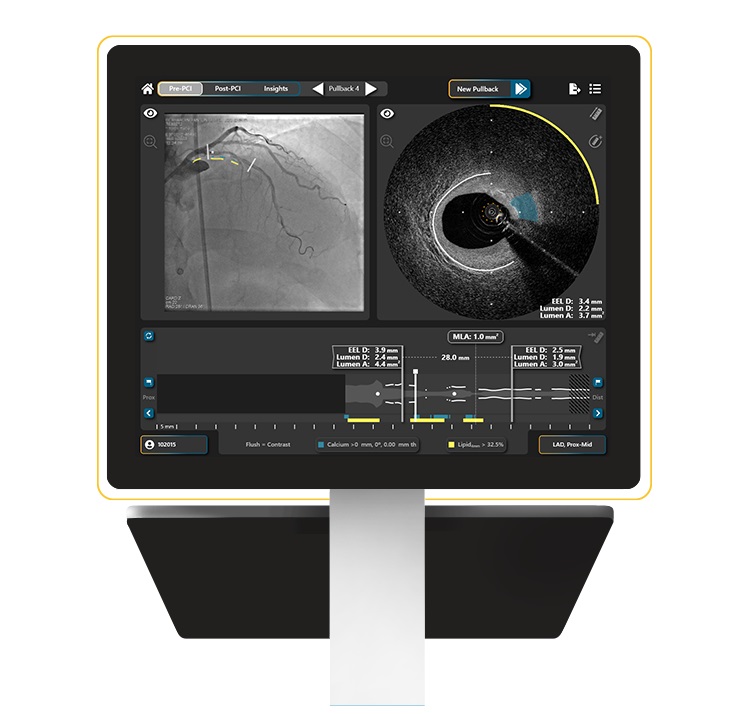 Imagen: El sistema de imágenes HyperVue (foto cortesía de SpectraWAVE)