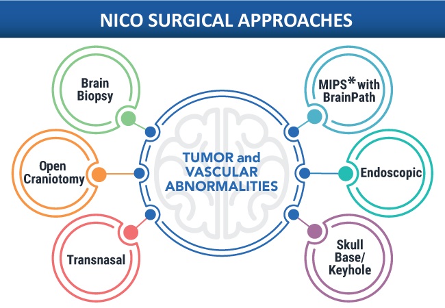 Imagen: La adquisición de NICO fortalece aún más el compromiso de Stryker con la neurotecnología a través del tratamiento de tumores y accidentes cerebrovasculares (foto cortesía de NICO)