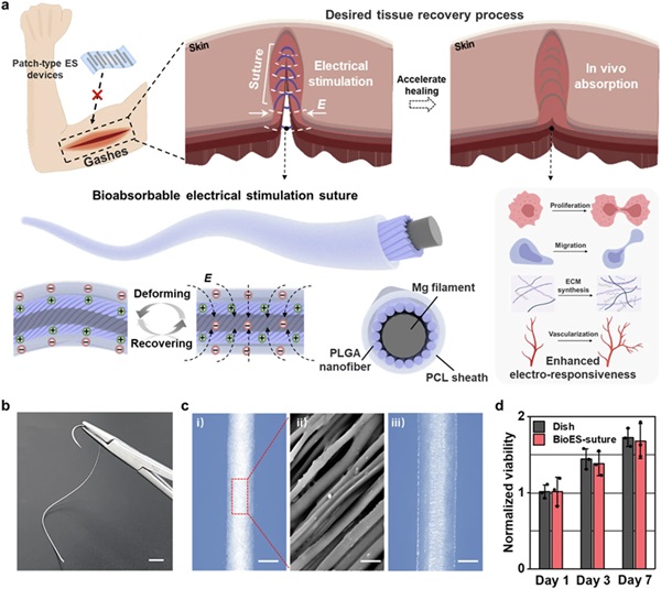 Imagen: Descripción general del concepto y diseño del material de la sutura de estimulación eléctrica bioabsorbible (fotografía cortesía de Nature Communications; DOI: 10.1038/s41467-024-52354-x)