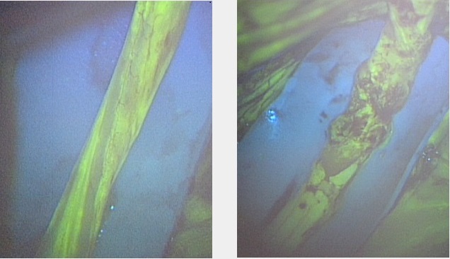 Imagen: La imagen de contraste con fluoresceína muestra el nervio ciático normal de un conejo, a la izquierda, y uno dañado (foto cortesía de Osaka Metropolitan University)