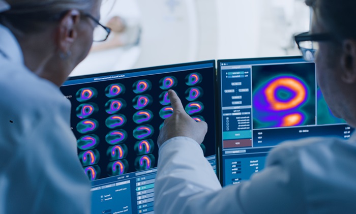 Imagen: Profesionales de la salud revisando imágenes PET de perfusión miocárdica (foto cortesía de GE Healthcare)