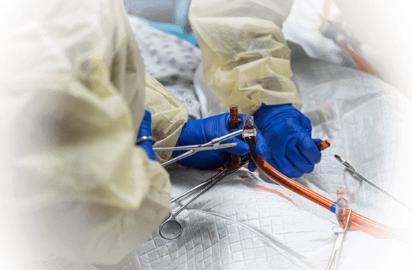 Imagen: CHEST ha publicado una nueva guía clínica sobre el procesamiento y la manipulación de muestras obtenidas mediante aspiración con aguja transbronquial guiada por ecografía endobronquial (foto cortesía del CHEST) Imagen: CHEST ha publicado una nueva guía clínica sobre el procesamiento y la manipulación de muestras obtenidas mediante aspiración con aguja transbronquial guiada por ecografía endobronquial (foto cortesía del CHEST)