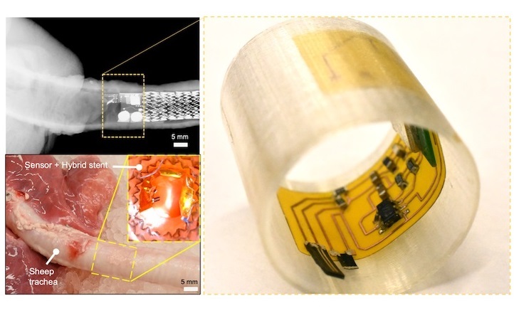 Imagen: Los investigadores han desarrollado un cilios sensoriales robóticos que monitorean biomarcadores internos para detectar y evaluar enfermedades de las vías respiratorias (Foto cortesía de la Universidad de Vanderbilt)