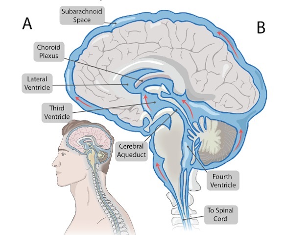 Imagen: los electrodos de catéter se pueden entregar y guiar hacia los espacios ventriculares y la superficie del cerebro para la estimulación eléctrica (foto cortesía de la Universidad Rice)