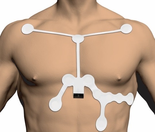 Imagen: Ilustración del parche EKG producido (Foto cortesía de MG Medical Products)