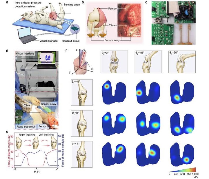 Imagen: Imagen: Diagrama esquemático de la detección de presión intraarticular utilizando un sistema sensorial en un modelo de oveja (Foto cortesía de Science China Press)