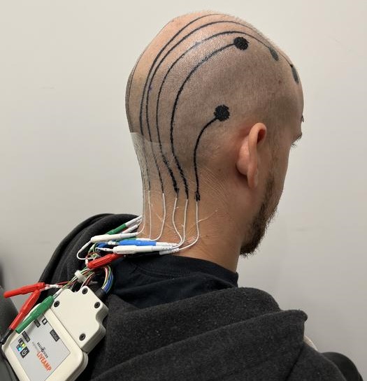 Imagen: Configuración de EEG con electrodos de tatuaje electrónico (foto cortesía de Nanshu Lu/Ut Austin)